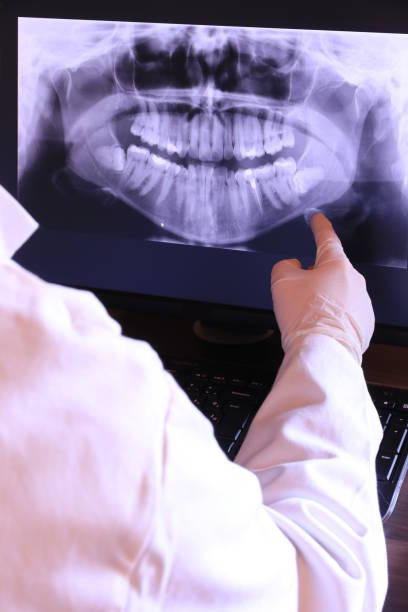 Best Knocked-Out Tooth (Avulsed Tooth) Treatment in Chambersburg, PA